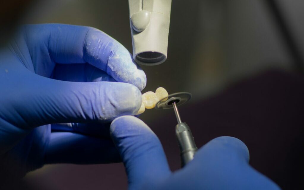 Материалы для протезирования зубов металлокерамикой — МедВестник