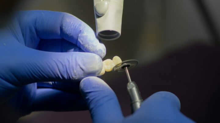 Материалы для протезирования зубов металлокерамикой — МедВестник